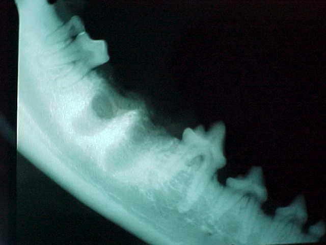 x-ray