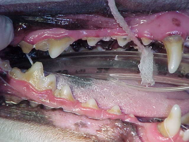 Dental Disease